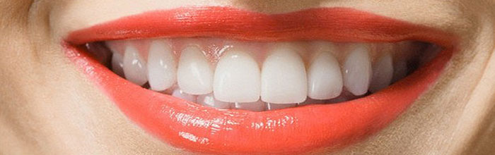AESTHETIC GINGIVAL RECONTOURING