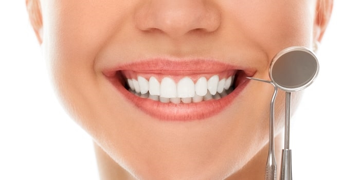 Diş Kaplama Yaptırmadan Önce Bilmeniz Gereken 3 Önemli Adım